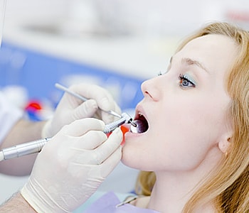 Root Canal Therapy in San Francisco CA